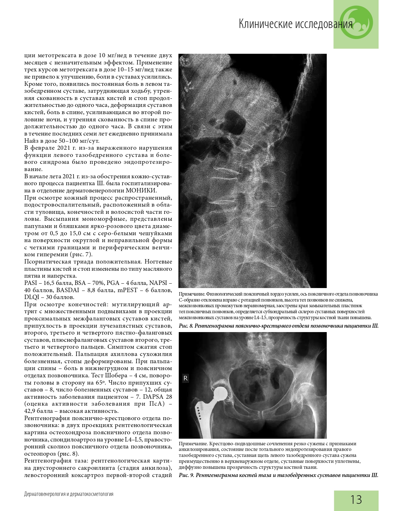 effektivnaya_farmakoterapiya_dermatovenerologiya_i_dermatokosmetologiya_1_2022_page-0015