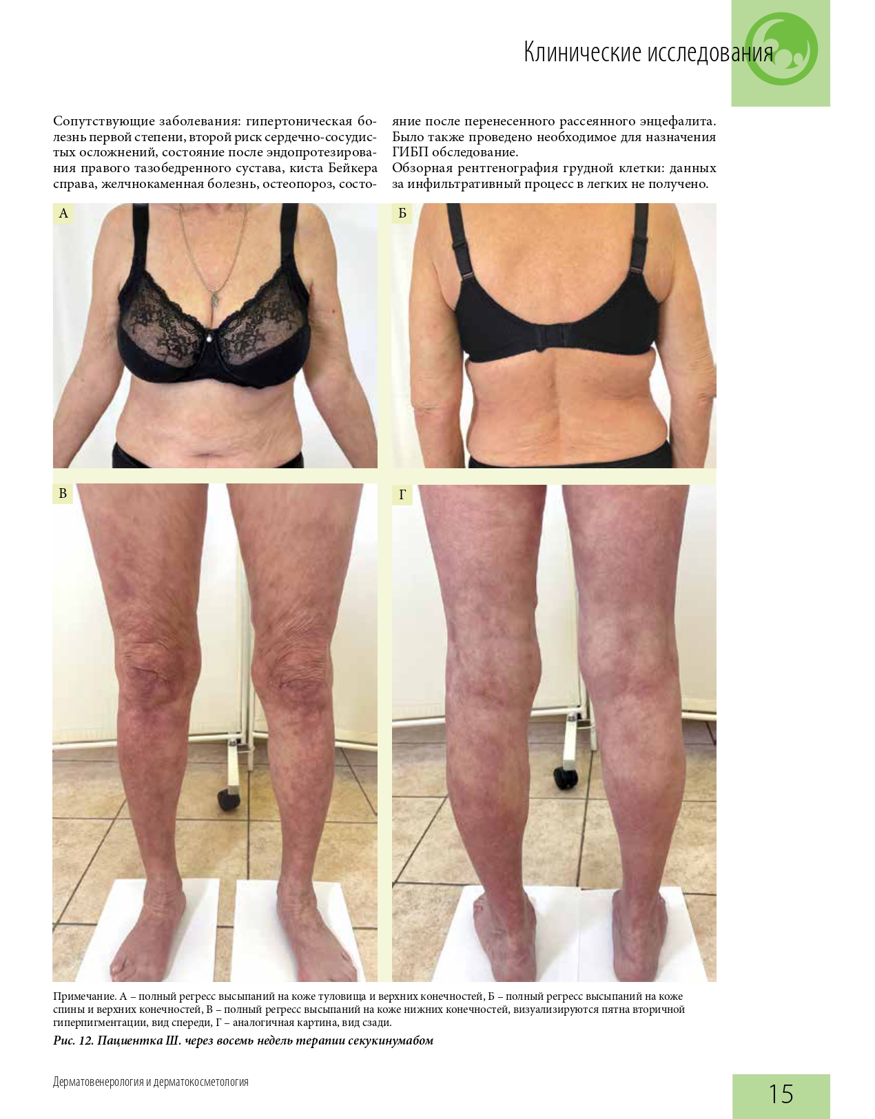 effektivnaya_farmakoterapiya_dermatovenerologiya_i_dermatokosmetologiya_1_2022_page-0017