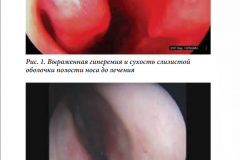 иллюстрации